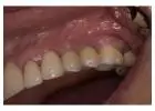Revive your natural and flawless smiles with holistic Dental care in Tijuana