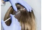 Exosomes Hair Therapy in Islamabad