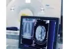Medical Ultrasound Machine Supplier