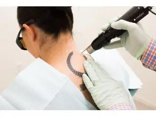 PicoWay Laser PicoWay Laser