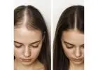 Regain Your Hair Naturally with the Best Hair Clinic in Noida