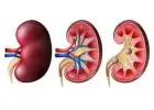Book Renal Function Test Online – Max Lab