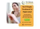 Top-Rated Pimple Treatment Center In Hyderabad | Dr. Venus