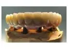 Get your natural look with metal-free Dental crowns in Tijuana from Teeth Savers