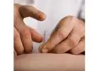 Acupuncture NYC | Sports Medicine & Dry Needling | Pain Management