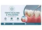 Teeth Scaling and Polishing in Islamabad